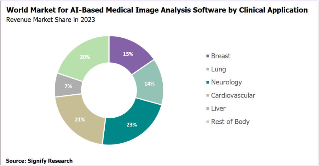 تصوير الدماغ والرئة هي أكثر المجالات النشطة في سوق الذكاء الاصطناعي